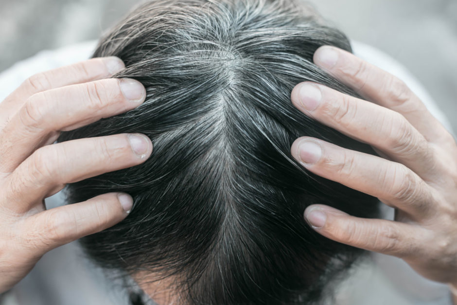 白髪の原因とは 育毛剤を活用して白髪を予防する方法を解説