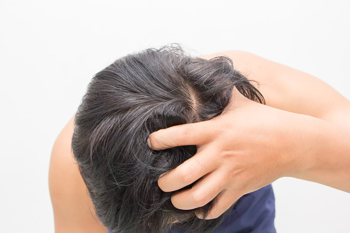 頭皮が硬い原因とは 硬さチェックやヘアケア 予防方法を紹介