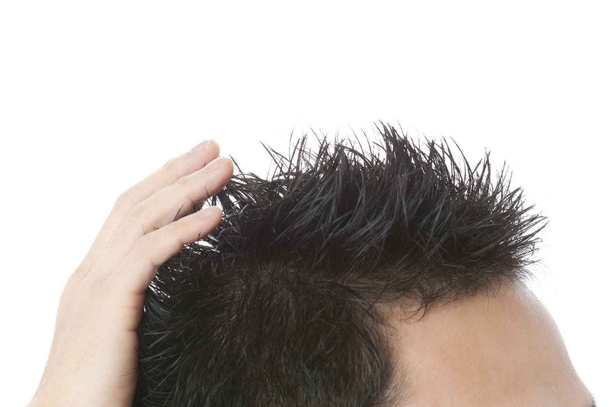 頭皮が痛い原因とは 日常生活からできる対策法5つもご紹介