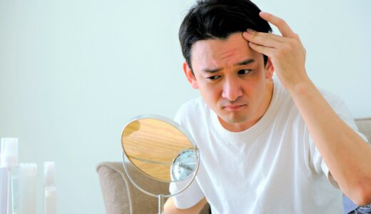 AGA（男性型脱毛症）の初期症状とは？原因や対策、おすすめの育毛剤を紹介